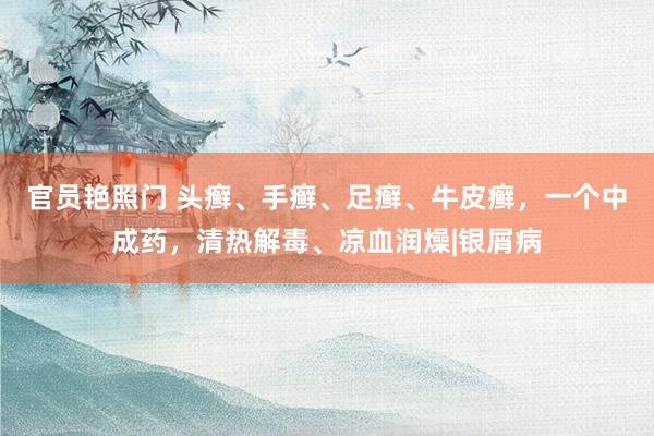 官员艳照门 头癣、手癣、足癣、牛皮癣,一个中成药,清热解毒、凉血润燥|银屑病